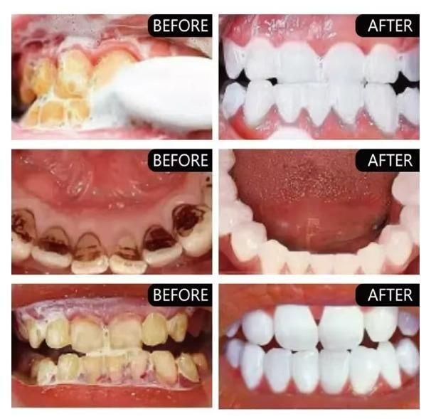 Smoke Stains White Plus Toothpaste 100g