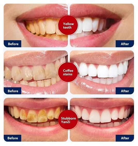 Smoke Stains White Plus Toothpaste 100g